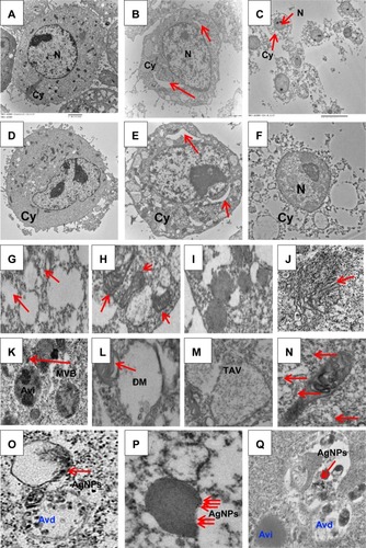 Figure 7 Cellular uptake of AgNPs induces accumulation of autophagosomes and autolysosomes.Notes: TM3 and TM4 cells were treated with AgNPs at IC50 for 24 hours and analyzed by transmission electron microscopy (TEM). TEM images showed TM3 (A–C, G–J) and TM4 (D, F, K–Q) cells: not treated with AgNPs (A, D) and AgNP-treated showing crescent-like vacuoles (B, E), autophagic vacuoles (C, F), and accumulation of autophagosomes, autolysosomes, and damaged mitochondria (G–J and K–Q). Red arrows indicate the formation of autolysosomes. Autophagic vacuoles (AV) were classified into three types based on morphological criteria: AV-initial (AVi), intermediated (Avi/d), and degradative (Avd). All experiments were carried out in triplicate and repeated at least three times.Abbreviations: AgNPs, silver nanoparticles; Cy, cytoplasm; IC50, half maximal inhibitory concentration; N, nucleus; TM3, Leydig; TM4, Sertoli; TAV, typical autophagic vacuoles; DM, damaged mitochondria; MVB, multivesicular bodies.
