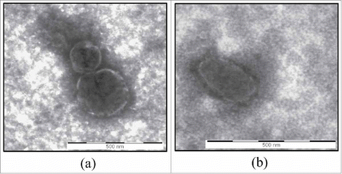 Figure 1. TEM analysis. Transmission electron microscopy images of vesicles isolated from conditioned medium of CABA I (a) and SKOV 3 (b) cells. Displayed vesicles measure 150 nm and 300 nm in Fig. 1a and 300 nm in Fig. 1b. Bar = 500 nm.