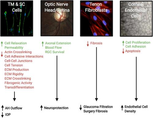 Figure 4 Therapeutic effects of Rho kinase (ROCK) inhibitors in treatment of glaucoma. They can increase aqueous humor (AH) outflow and decrease intraocular pressure (IOP) by targeting the cytoskeleton of the trabecular meshwork (TM) and Schlemm’s canal (SC) cells. ROCK inhibitors also have a neuroprotective effect by increasing blood flow to the retina and optic nerve, promoting axonal regeneration, and increasing retinal ganglion cell (RGC) survival. In addition, the inhibitory effect on Tenon fibroblasts decreases the fibrosis after filtration surgery. Finally, on the corneal endothelium they enhance cellular proliferation, promote adhesion, and suppress apoptosis. Accordingly, they provide a greater potential for the regeneration of damaged corneal endothelium and restoration of corneal transparency. The photos shown were taken at the Departments of Ophthalmology at UT Southwestern Medical Center Dallas, Texas, USA and King Hussein Medical Center Amman, Jordan. Adapted with permission from Rao PV, Pattabiraman PP, Kopczynski C. Role of the rho GTPase/rho kinase signaling pathway in pathogenesis and treatment of glaucoma:bench to bedside research. Exp Eye Res. 2017;158:23–32. © 2016 Elsevier Ltd. All rights reserved.Citation8