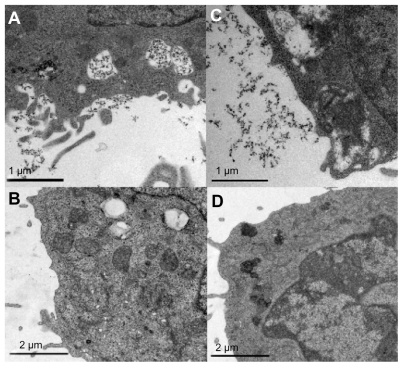 Figure 2 Representative electron microscopy images of cells: THP-1 in (A) and (B); Ba/F3 in (C) and (D). (A) and (C) show gadolinium oxide incubated cells (treated with protamine sulfate and 2.0 mM gadolinium). Gadolinium oxide nanoparticles are visible inside vacuoles of the cell. Images (B) and (D) show control cells not treated at all. These cells do not have as many vacuoles indicating that they were not phagocytically active.