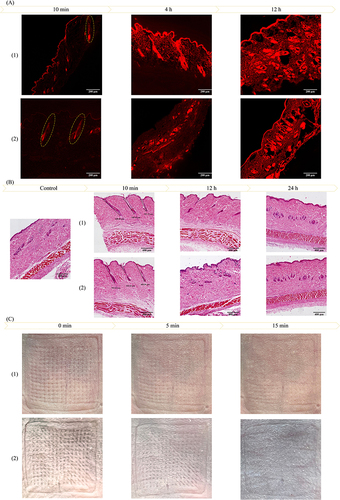 Figure 6 (A) Changes in fluorescence intensity and depth of skin at different time points (10×, Scale bars = 200 μm) and safety evaluation. (B) Tissue section results (5×, Scale bars = 400 μm); (C) Healing at the microneedle administration site; 1: Rh-NPs-DMNs; 2: Rh-DMNs).