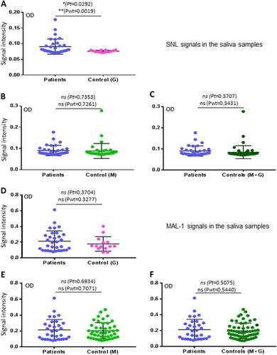 Fig. 4 Assessments of associations between the SNL- and MAL I-binding signals to saliva samples and H7N9 infection.a–c Comparisons of the SNL-binding signals to the saliva samples between the patients and the two uninfected controls in three combinations: a patients vs. control G; b patients vs. control M; c patients vs. controls G + M. d–f Comparisons of the MAL I-binding signals to the saliva samples between the patients and the two uninfected controls in three combinations: d patients vs. control G; e patients vs. control M; f patients vs. controls G + M. Y-axis indicates signal intensities, while X-axis showed the compared experimental groups. The statistical differences between data groups are analyzed by t-test (t) as well as Welch’s t-test (wt) and their P values (Pt and Pwt) are shown and indicated by asterisks (*P < 0.05; ns, P > 0.05)