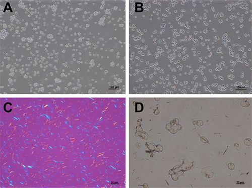 Figure 1 THP-1 cell morphology and phagocytosis of monosodium urate crystals. THP-1 cells were suspended with round surfaces (A) and then became adherent with pseudopodia after 3 hours of phorbol 12-myristate 13-acetate (PMA) induction (B). Monosodium urate (MSU) crystals showed birefringence under polarized light (C) and were engulfed by THP-1 cells (D). Bars = 20 μm or 100 μm as indicated. n=3/group.
