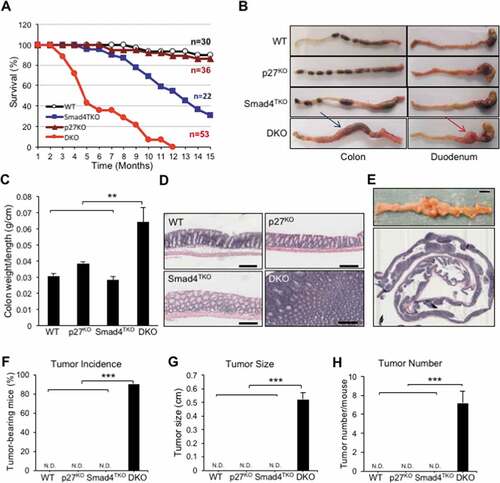 Figure 2. Deletion of p27kip1 in Smad4TKO mice accelerates colitis-associated colon cancer. A) Survival curves of WT, Smad4TKO, p27KO and Smad4TKO/p27Kip1-/- (DKO) mice. B) Photographs of colon, stomach and duodenum from each genotype at 3 months of age. C) Colon weight per length (g/cm) (n = 9). D) Hematoxylin and eosin (H&E) staining of the colon of each genotype at 3 months of age. Scale bar = 100 µm. E) Photograph and mucosal histology of the colon from DKO mice at 3 months of age. Paraffin-embedded sections were stained with H&E. Scale bar = 1 cm. F) Percentage of tumor-bearing mice (n = 10). G) Tumor size (n = 7). H) Tumor numbers per mouse at 3 months of age were determined using a digital eyepiece and an imageJ (n = 7). Error bars indicate S.E.; ***P < .001, **P < .01 compared with each genotype such as WT, p27KO and Smad4TKO