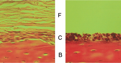 Figure 3. Histology of periosteum-bone complex during the sequential enzymatic digestion method. (A) Periosteumbone complex after 30 min of trypsin digestion. (B) After 2 h of collagenase digestion, only cambium layer cells remained on the cortical bone. (F: fibrous layer; C: cambium layer; B: bone).