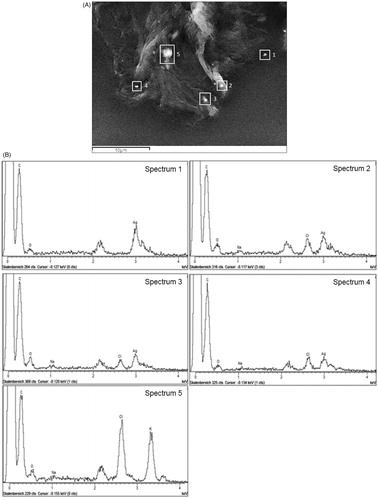 Figure 5. (A). SEM image of SC tape strip after wearing of silver garment. Micrometric aggregates on the corneocyte surface found on tape strip no. 5. (B): Corresponding EDX spectra of five bright spots (white rectangles) in the SEM image (A) showing different composition of the particles.