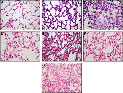 Figure 10 Representative histological sections (magnification ×400) from control (A), IRB 30% (B) and IRB 40% (C), ERB 40% (D) and ERB 70% (E), and CRB 30%/50% (F) and CRB 40%/60% (G) groups. Neutrophilic infiltration, capillary congestion, and focal thickening of the alveolar membrane are evident in lower resistive loads but are significantly more pronounced in the highest load of each group, especially CRB 40%/60%.