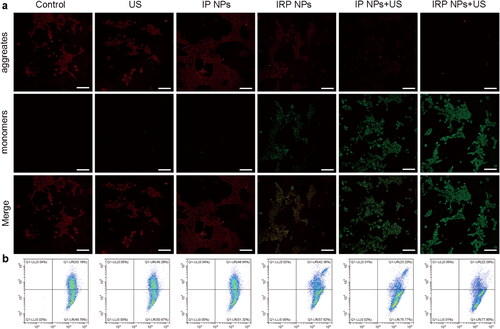 Figure 4. Mitochondria membrane potential. (a) Mitochondria membrane potential changes of 4T1 cells after corresponding treatments observed using CLSM (scale bar: 100 µm). (b) JC-1 assay as a measure of mitochondrial depolarization by flow cytometry.