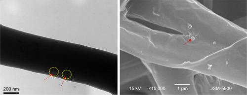 Figure S1 Bio-TEM (left) and SEM images (right) of PDO composite fiber with red arrow showing PD NPs closer to the fiber surface.Abbreviations: Bio-TEM, bio-transmission electron microscopy; PD NPs, polydopamine nanospheres; PDO, polydioxanone; SEM, scanning electron microscopy.