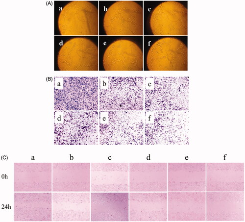 Figure 6. Inhibitory effects on VM channels, invasion and wound healing of U87 cells. (A) Inhibiting effects on VM channels formation in vitro after treatments with the varying micellar formulations. (B) Blocking invasive effects on U87 cells in vitro after treatments with the varying micellar formulations. (C) Blocking wound healing effects on U87 cells in vitro after treatments with the varying micellar formulations. a. blank micelles, b. paclitaxel micelles; c. artemether plus paclitaxel micelles; d. BK modified artemether plus paclitaxel micelles; e. MAN modified artemether plus paclitaxel micelles; f. dual-targeted artemether plus paclitaxel micelles.