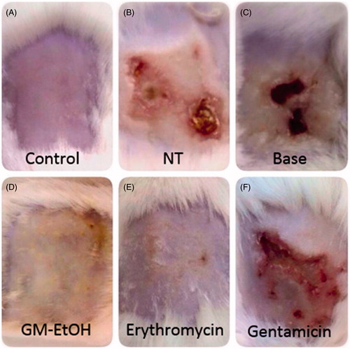 Figure 6. The effect of GM-EtOH on the wound-appearance. The photograph of the wound was recorded daily (n = 9–10) after the treatments. The figure showed the wound-appearance on the last day of observation (the ninth day). Control, non-infected mice with the tape stripping induced wound; NT, MRSA-infected wound in mice with no treatment; Base, MRSA-infected wound in mice treated with 100 μL of a 10% ethanol in propylene glycol solution; GM-EtOH, MRSA-infected wound in mice treated with 100 μL of a 10% GM-EtOH in a 10% ethanol in propylene glycol solution; Erythromycin, MRSA-infected wound in mice treated with 100 μL of a 4% commercial erythromycin gel; Gentamicin, MRSA-infected wound in mice treated with 100 μL of a 0.1% commercial gentamicin cream.