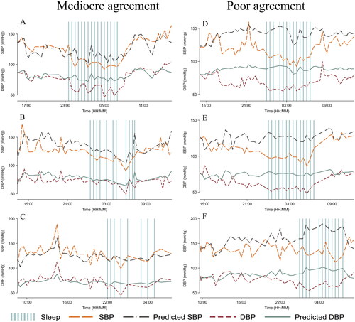 Figure 3. Time series plots from six different participants of systolic blood pressure (SBP) and diastolic blood pressure (DBP) from the cuff-based oscillometric device (ReferenceBP) and PAT-based blood pressure (BP) model (Predicted BP). Three subjects with mediocre agreement (A + B + C) and three subjects with poor agreement (D + E + F).