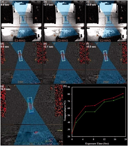 Figure 8. The procedure applied for MRgFUS sonication of nanoparticles. (a–c) Magnetic resonance phase images of a typical thermosensitive phantom containing drug-loaded PMSNs during MRgFUS heating. (d–g) The temperature patterns obtained during the heating process, where higher temperatures are shown in red. (h) The temperature plot of the focal point during sonication of the phantom.