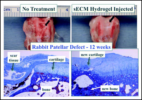 Figure 6 Cartilage repair in an osteochondral defect with a cell-free two-component sECM hydrogel. Left, rabbit patellar groove defect with no treatment results in extensive scar tissue after three months. Right, filling the defect with Extracel™ hydrogel results in regeneration of both new osteal and chondral tissues by invasion of the sECM by host-derived cells.