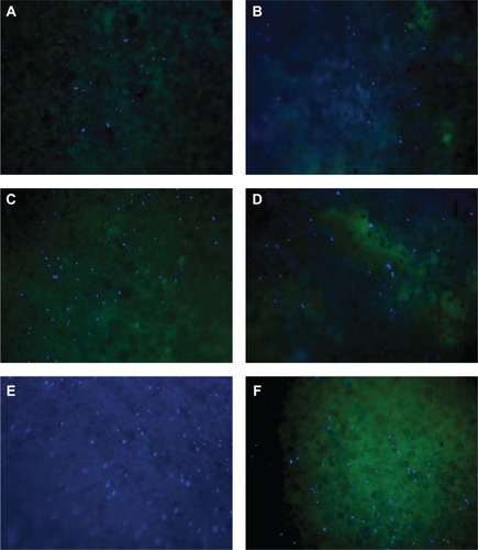 Figure 8 Fluorescent microscope images of different kinds of bone cements used during cell proliferation tests. (A) PMMA, (B) PMMA with MgO, (C) PMMA with HAp, (D) PMMA with CS, (E) PMMA with BaSO4, and (F) PMMA with SiO2.Abbreviations: CS, chitosan; HAp, hydroxyapatite; MgO, magnesium oxide; PMMA, poly(methyl methacrylate); BaSO4, barium sulfate; SiO2, silica.