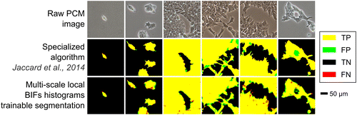 Figure 6 Comparison of the output from the proposed method with that of a previously described specialised PCM image segmentation algorithm. Images shown are from the mESCs data-set. Trainable segmentation based on five scales local BIFs histograms. For the specialised algorithm, images were processed using optimal segmentation parameters determined using the same mESC data-set as reported in the original paper (Jaccard et al. Citation2014). TP is true positives, FP is false positives, TN is true negatives and FN is false negatives.