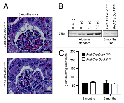 Figure 4.Pod-Cre+Dock1flx/flx mice display normal glomerular structure and function. (A) H&E-staining showing the normal glomerular development of 3 mo old Pod-Cre-Dock1flx/flx and Pod-Cre+Dock1flx/flx mice (Scale bar 20 μm, 40x). (B) Absence of proteinuria in the urine of 3-mo old Pod-Cre-Dock1flx/flx and Pod-Cre+Dock1flx/flx mice. Coomassie stained protein gel showing BSA standards (left) and the albumin content from the urine (right) of 3 mo old Pod-Cre-Dock1flx/flx and Pod-Cre+Dock1flx/flx mice. (C) Normal renal function in the absence of Dock1 expression in podocytes. Quantification of the average albumin-to-creatinine ratios in the urine of Pod-Cre-Dock1flx/flx and Pod-Cre+Dock1flx/flx mice at 3 and 6 mo after their birth (n = 5).
