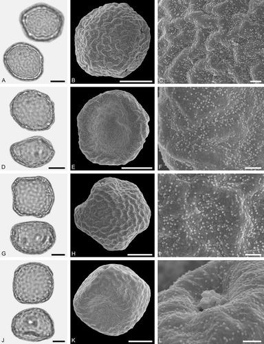 Figure 21. LM (A, D, G, J) and SEM (B, C, E, F, H, I, K, L) micrographs of dispersed fossil Ulmaceae pollen. A–F. Ulmus sp. 2, same grain with five pori, distal side of grain (B, C), and proximal side of grain (E, F). G–I. Zelkova sp., grain with four pori, distal side (H, I). J-L. Zelkova sp., grain with four pori, proximal side of grain (K), close-up of pori showing membrane (L). Scale bars – 10 µm (A, B, D, E, G, H, J, K), 1 µm (C, F, I, L).