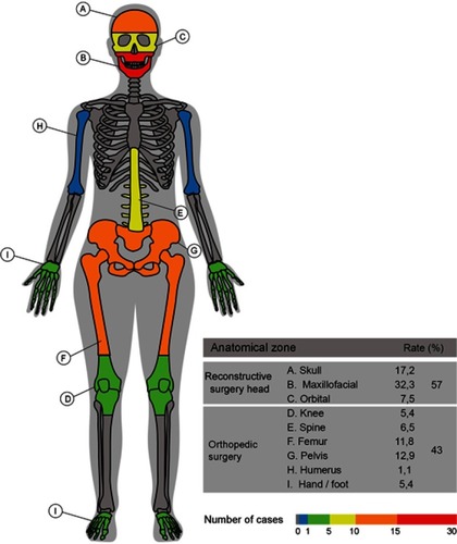Figure 5 Anatomical regions treated with specific-patient devices.