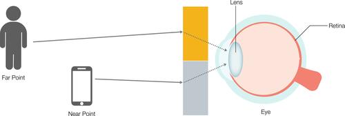 Figure 2 Varying the refractive power across the field requires optics that utilize two or more focusing zones. In this example, representing a bifocal correction, objects at far (person) are focused by an optic powered for far (orange rectangle), and objects at near (smartphone) are focused by an optic powered for near (grey rectangle). The viewer must either move the optic itself or physically adjust the eye gaze to utilize the appropriate viewing zone.
