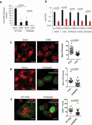 Figure 4. TFEB [Δ60] impairs the signaling of lysosomal biogenesis. (a) Transcriptional activity of WT-TFEB and TFEB [Δ60]. TFEB transcriptional activity was measured using 4× CLEAR luciferase reporter (mean ± SD, n = 3) following 5 h CVB3 infection (MOI = 10). (b) mRNA levels of TFEB transcriptional targets following expression of TFEB [Δ60]. HeLa cells were transfected with control vector or TFEB [Δ60] for 24 h. Cellular RNA was analyzed by real-time quantitative PCR for the expression of several TFEB target genes as indicated and normalized to ACTB (mean ± SD, n = 3). (c-d) LysoTracker Red (LTR) signals following CVB3 infection (c) or expression of TFEB [Δ60]. HeLa cells were either sham or CVB3 infected (MOI = 10) for 5 h (C) or transfected with control vector or TFEB [Δ60]-GFP for 24 h (d). Nuclear localized TFEB [Δ60] was visualized with GFP fluorescence (D). LTR dye was used as proxy for lysosomal pH measurement and mean LTR intensity was quantified in right panels. More than 30 cells were counted for statistical analysis. Scale bars: 20 μm. (e) LAMP1 signals following expression of WT-TFEB or TFEB [Δ60]. HeLa cells were transiently transfected with WT-TFEB-GFP or TFEB [Δ60]-GFP for 48 h. Cells were fixed and immunostained with anti-LAMP1 antibody. The number of LAMP1-positive structures was visualized by confocal microscopy and quantified from n = 30 cells per condition and presented in the right panel. Scale bars: 20 μm