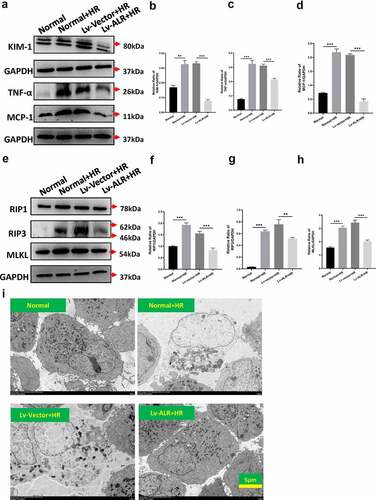 Figure 6. The effects of overexpression of 23-kD ALR on HR-induced HK-2 cell damage and necroptosis-associated proteins. Western blotting (a) and quantitative data on KIM-1 (b) and the inflammation-associated cytokines TNF-α(c) and MCP-1 (d). Western blotting (e) and quantitative data on the necroptosis-associated proteins RIP1 (f), RIP3 (g) and MLKL (h). The effects of overexpression of 23-kD ALR on cell morphology (i) by TEM, scale bar: 5 µm. Data represent the mean ± standard deviation of at least three independent experiments, *P < 0.05, **P < 0.01, ***P < 0.001.