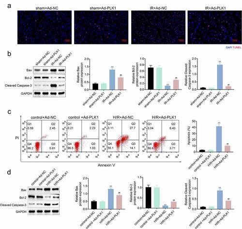 Figure 3. Overexpression of PLK1 relieved the ischemia reperfusion induced apoptosis of myocardium of rats. (a) the apoptosis of myocardium detected by tunel staining. (b) Western blot analysis of the expression of apoptosis related proteins in myocardium. (c) flow cytometry analysis of the apoptosis of H9c2 cells by. (d) Western blot analysis of the expression of apoptosis related proteins in H9c2 cells. ##p < 0.01 IR+Ad-PLK1 vs IR+Ad-NC, **p < 0.01 sham+Ad-NC vs IR+Ad-NC