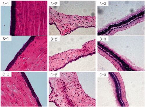 Figure 8. Histopathology images of the cornea (1), iris (2), and sclera (3) after treatment with: Normal saline(A), PLGA nanoparticles (B), and 2-HP-β-CD/PLGA nanoparticle complexes (C). PLGA, Polylactic-co-glycolic acid; 2-HP-β-CD, 2-HP-β-cyclodextrin.