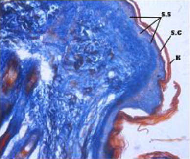 Figure 3. Stratum spinosum (S.S), stratum cornium (S.C), stratum basali, epidermis and dermis and Keratin layer in Ayoub Schklar X 200.