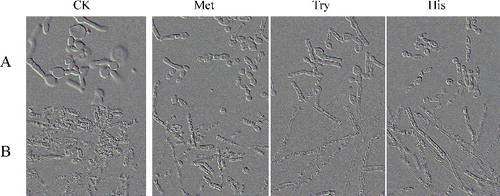 Figure 4. The cell morphology of T. cutaneum B3 cultivated on non-buffered and buffered YNB-based medium with 1% glucose as carbon source and 0.02% methionine or 0.02% tryptophan or 0.01% histidine as required. The cells were photographed at 1000× magnifications after 72 h growth on the medium and the inoculum was 100% yeast-like cells. A: non-buffered; B: citrate-buffered; CK: YNB-based medium contained 1% glucose without those three amino acids.