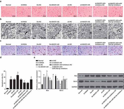 Figure 3. Downregulated BACE1-AS represses substantia nigra neuronal injury and apoptosis in PD rats. A. Detection of the pathological changes of substantia nigra neurons of rats in each group by HE staining; B. Observation of ultrastructure of substantia nigra neurons of rats in each group by TEM; C. Detection of the apoptosis of substantia nigra neurons of rats in each group by TUNEL staining; D. Quantitative results of the apoptosis of substantia nigra neurons of rats; E. Bax and Bcl-2 protein expression in the substantia nigra of rats in each group; the data in the figure were all measurement data expressed as mean ± standard deviation; a, P < 0.05 vs the normal group; b, P < 0.05 vs the oe-NC group; c, P < 0.05 vs the sh-NC group; d, P < 0.05 vs the sh-BACE1-AS+inhibitors NC group