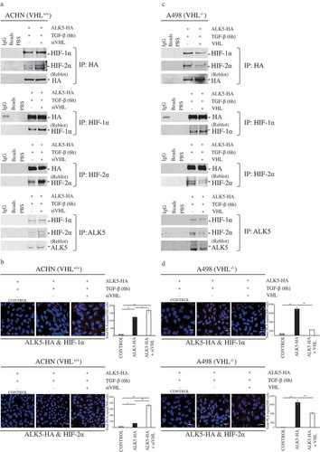 Figure 4. Immunoprecipitation and Proximity Ligation Assay shows interaction of ALK5 with HIF-1α and HIF-2α. (a) Immunoblots show IP with HA or HIF-1α or HIF-2α or ALK5 antibody: ACHN cells were transfected with ALK5-HA or co-transfected with ALK5-HA and siVHL vectors, followed by TGF-β treatment for 6h, and probed with HA or HIF-1α, or HIF-2α or ALK5 antibody, respectively. (b) Proximity Ligation Assay (PLA): ACHN cells were transiently co-transfected with indicated vectors, followed by TGF-β treatment for 6h. After fixation and blocking, PLA was performed using HA and HIF-1α or HIF-2α antibodies. HIF-1α-ALK5-HA complexes or HIF-2α-ALK5-HA complexes were visualized as red signals. Scale bar 50 μm (PLA performed without adding one of the primary antibodies served as the control, student’s T-test, significant at *P < 0.05, **P < 0.005, mean ± SD of three experiments, 500 cells were analyzed in each group). (c) Immunoblots show IP with HA or HIF-1α or HIF-2α or ALK5 antibody. A498 cells were transfected with ALK5-HA, or co-transfected with ALK5-HA and VHL vectors, followed by TGF-β treatment for 6h, and probed with HA or HIF-1α, or HIF-2α or ALK5 antibody, respectively. (d) Proximity Ligation Assay (PLA): A498 cells were transiently co-transfected with indicated vectors, followed by TGF-β treatment for 6h. After fixation and blocking, PLA was performed using HA and HIF-1α or HIF-2α antibodies. HIF-1α-ALK5-HA complexes or HIF-2α-ALK5-HA complexes were visualized as red signals. Scale bar 50 μm (PLA performed without adding one of the primary antibodies served as the control, student’s T-test, significant at *P < 0.05, **P < 0.005, mean ± SD of three experiments, 500 cells were analyzed in each group).