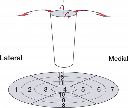 Figure 3. The upper femur treated as a cylinder, folded out so that it becomes a disc named a Polar Map. Each of the 7 Gruen zones represents 1 ROI in the disc; 6 other ventral or dorsal ROIs complete all the regions adjacent to the stem.