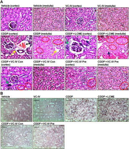 Figure 4. VC-IV reduced CDDP-induced renal damage in mice. (a) Photomicrographs of kidney sections of mice stained with hematoxylin and eosin (H and E). Normal histology with renal corpuscle, proximal, and distal convoluted tubules was observed in vehicle-treated and only VC-IV-treated group. Large area of interstitial hemorrhage (black color double headed arrow), atrophy (yellow color arrow) and loss of brush border (red color oval) were found in CDDP-treated group. Loss of brush border (red color oval), tubular dilatation (blue color arrow), and leukocyte infiltration (green color arrow) were found in CDDP + LCME-treated group. CDDP + VC-IV concomitant-treatment group showed moderate loss of brush border (red color oval) and mild leukocyte infiltration (green color border). Quite normal histology was observed in CDDP + VC-IV pre-treatment group except mild loss of brush border. (b) Photomicrographs of kidney sections of mice stained with TUNEL reagent (BCIP/NBT), × 400 magnification, scale bar = 50 μm. CDDP treatment resulted in apoptosis (TUNEL-labelled cells) around glomerulus and proximal convulated tubules. CDDP + LCME-treated group also showed apoptosis around glomerulus and proximal convulated tubules. Treatment with VC-IV in concomitant- and pre-treatment schedule showed null or minimal presence of apoptotic cells.