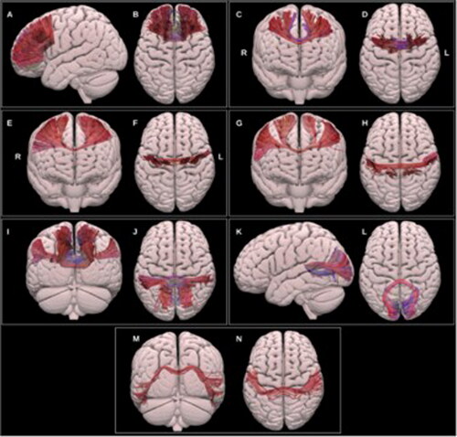 FIGURE 2. Copied with permission from Radwan et al. (Citation2022). Multiple projections of the semitransparent MNI pial surface. A-B: prefrontal CC, C-D: PMC and SMA CC, E-F: motor CC, G-H: sensory CC, I-J: parietal CC, K-L: occipital CC, M-N: temporal CC.