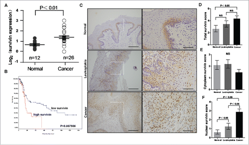 Figure 1. Survivin is upregulated in OSCC. (A) Oncomine-derived data analysis of survivin mRNA expression in normal oral tissue and OSCC. (Kruskal-Wallis test, P < 0.01; normal oral n = 12, OSCC n = 26) (B) Patient survival obtained from publicly available microarray data was analyzed based on survivin mRNA expression level. (C) Representative images of survivin expression in normal oral tissues, leukoplakias and OSCCs via immunohistochemical (IHC) staining. Scale bar: 50 um. (D) IHC scores of survivin expression in normal, leukoplakia and OSCC tissues.