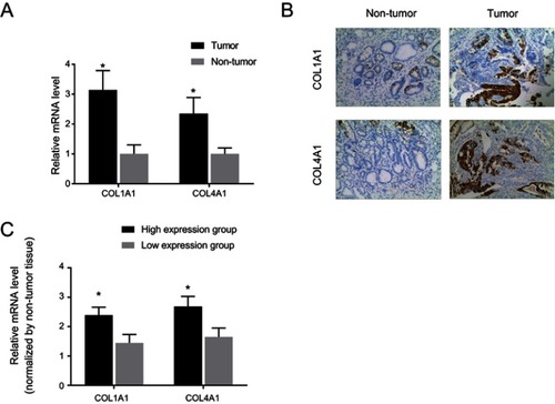 Figure 8 Expression of COL1A1 and COL4A1 in the tissue samples from an independent in-house gastric cancer-related cohort. (A) qRT-PCR showed a higher COL1A1 and COL4A1 level in tumor tissues; (B) Representative images of immunohistochemical staining for COL1A1 and COL4A1 expression in tissue samples (100×). The higher positive rate of COL1A1 and COL4A1 was observed in tumor tissues. *P<0.05 compared with non-tumor tissues; (C) the expression difference folds of COL1A1 and COL4A1 between high expression and low expression groups.