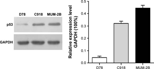 Figure 2 Expression of p53 protein in MUM-2B, C918, and D78 cells as detected by Western blot.