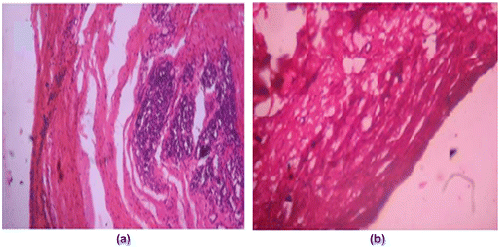 Figure 17. Wound healing activity of (a) plain (AD-X-CAS) film (b) GS loaded (DA-X-CAS)1190 film.