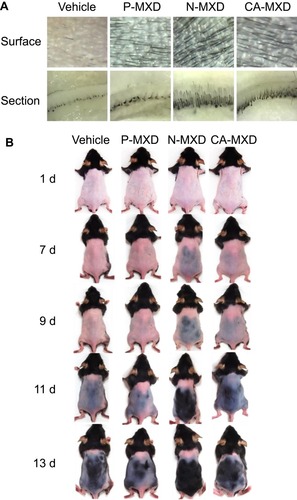 Figure 4 Images showing the hair-growth effects of the repetitive application of MXD formulations in C57BL/6 mice.Notes: (A) Microscopic image of the skin surface and skin cross-section of C57BL/6 mice skin after 10 d of repetitive application of MXD formulations (once a day). (B) Digital photo image of C57BL/6 mice treated repetitively with MXD formulations for 13 days (once a day). Vehicle, mice applied with the vehicle used to prepare P-MXD and N-MXD. P-MXD, P-MXD-applied mice. N-MXD, N-MXD-applied mice. CA-MXD, CA-MXD-applied mice. Hair growth was promoted by the application of N-MXD and CA-MXD, and the drug efficacy of N-MXD was higher than that of CA-MXD. In addition, no redness or inflammation was observed in skin after the repetitive applications of N-MXD.Abbreviations: CA-MXD, commercially available minoxidil formulation; MXD, minoxidil; N-MXD, formulation based on minoxidil nanoparticles; P-MXD, formulation based on minoxidil powder.