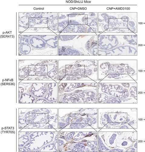 Figure 6 Immunohistochemistry analyses of the classic downstream of CXCL12/CXCR4 axis between prostate tissues derived from chronic nonbacteria prostatitis (CNP) and negative controls, including AKT, NF-κB, and STAT3 signaling.