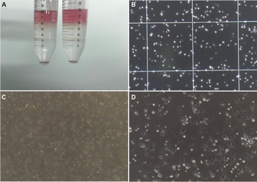 Figure 1 Isolation and culture of NPSCs.Note: (A) Percoll density gradient centrifugation layering; (B) cell count after isolation (200×); (C) the cell morphology of freshly isolated NPSCs (200×); (D) cell morphology of NPSCs gradually adhering after 12 hours of culture (200×).Abbreviation: NPSC, normal pancreatic stellate cell.