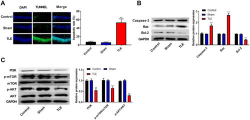 Figure 2 The apoptosis of the hippocampal neurons was increased and the PI3K/AKT/mTOR pathway was inhibited in rats with TLE. (A) The apoptosis of hippocampal neurons was detected using the TUNEL assay. (B) The expression of proteins related to apoptosis (Caspase-3, Bax and Bcl-2) was detected using Western blot. (C) The expression of proteins related to the PI3K/AKT/mTOR pathway was detected using Western blot. **P < 0.01 vs Control and Sham groups.