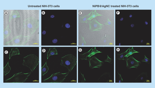 Figure 5.  Confocal cell images of NIH-3T3 cells stained with DAPI and Alexa Fluor 488 phalloidin.(A–D) NIH-3T3 cells were kept as untreated. (A) Merged images of all filters, (B) DAPI stained for nucleus of untreated cell, (C) Alexa Fluor 488 phalloidin staining for actin filaments and (D) merged images of blue and green filter of untreated cells. (E–H) Confocal images of NIH-3T3 cells were incubated with NiPB@AgNC (7.5 μl/ml corresponds to [Ag] = 105 μM) for 24 h). (E) Merged images of all filters, (F) DAPI stained for nucleus, (G) Alexa Fluor 488 phalloidin staining for actin filaments and (H) merged images of blue and green filter.NiPB@AgNC: Nickel-prussian blue@silver nanocomposite.
