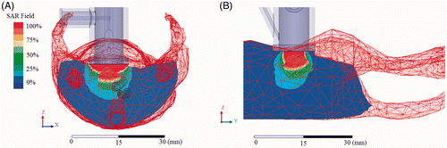 Figure 4. HFSS™ SAR simulation in mouse model (A) x-axis profile and (B) y-axis profile.