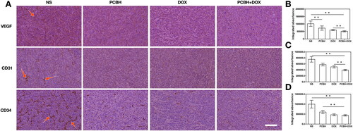 Figure 5. The angiogenesis of tumors with different treatments. (A) VEGF, CD31 and CD34 immunohistochemical staining image s on day 14, scale bar = 50 μm. Quantitative analysis of the relative density of (B) VEGF, (C) CD31 and (D) CD34 from immuno histochemically stained tumor section after treatments. Data are expressed as mean ± SD (n = 7), ** represented p < 0.01.