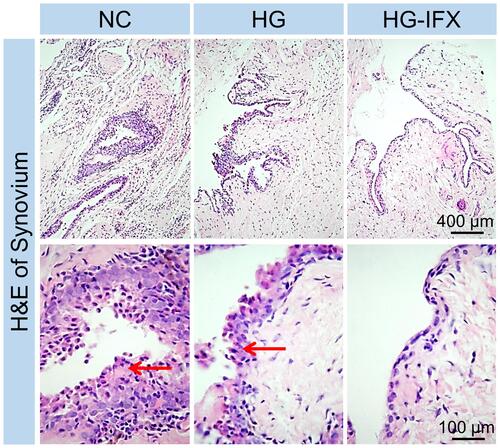 Figure 7 Improvement of synovial inflammation treated with IFX-loaded hydrogel. Typical synovium in each group stained with H&E at 6 weeks post-injection (red arrows indicate synovial hyperplasia and inflammatory cell infiltration).