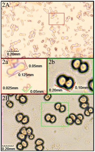 Figure 2 Cultures of CNPs observed through inverted phase contrast microscopy at 2–4 weeks. A) Particles were individually separated and were typically in coccoid, bacilliform, or dumbbell shape with a highly refractile crust after 2-week culture. a) Enlarged picture of (A) showing the particles were very tiny with a diameter of 0.025–0.05 mm. B) Particles grew bigger after 4-week culture. b) Enlarged picture of (B) showing the average diameter was about 0.10 mm.