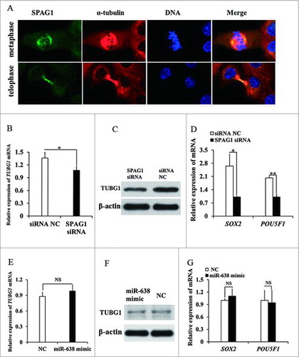 Figure 6. SPAG1 is required for spindle morphogenesis. (A) Cellular localization of SPAG1 was detected by immunofluorescent analysis. ST cells at indicated stages were immunostained for SPAG1 (green), microtubule (red; α-tubulin) and DNA (blue). (B) ST cells were treated with nocodazole for 9 h, following transfected with SPAG1 siRNA or siRNA NC. Total cellular lysates were prepared for Q-PCR of TUBG1 gene. (C) Total cellular lysates were extracted from ST cells transfected with SPAG1 siRNA or siRNA NC, and then prepared for Western blot of TUBG1. (D) Total cellular lysates were extracted from ST cells transfected with SPAG1 siRNA or siRNA NC, and then prepared for Q-PCR of SOX2 and POU5F1 gene. (E) ST cells transfected with miR-638 mimics or NC were prepared for Q-PCR of TUBG1 gene. (F) ST cells transfected with miR-638 mimics or NC were prepared for Western blot of TUBG1. (G) Total cellular lysates were extracted from ST cells transfected with miR-638 mimics or NC, and then prepared for Q-PCR of SOX2 and POU5F1 gene. Data are presented as the mean ± S. D. (three independent replicates per group). * P < 0.05, N.S. = non-significant.