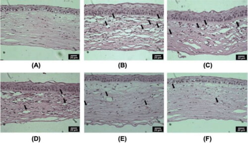 Figure 13. H&E staining of cornea: (A) Hematoxylin and eosin (HE) staining of corneal sections in the normal group(400x); (B) HE staining of corneal sections in the saline group (400 ×); (C) HE staining of corneal sections in the 0.05% ISL-NE group (L group) (400 ×); (D) HE staining of corneal sections in the 0.1% ISL-NE group (M group) (400x); (E) HE staining of corneal sections in the 0.2% ISL-NE group (H group) (400x); (F) HE staining of corneal sections in the glucocorticoid group (DXMS group) (400x). The black arrow indicates CNV.